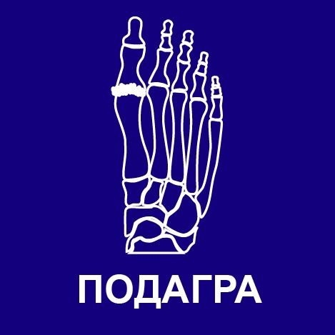 программа лечения подагры